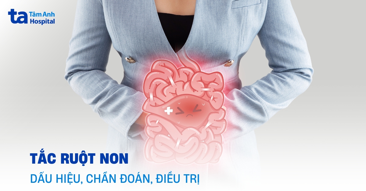 Nhận biết sớm tắc ruột non để xử lý kịp thời