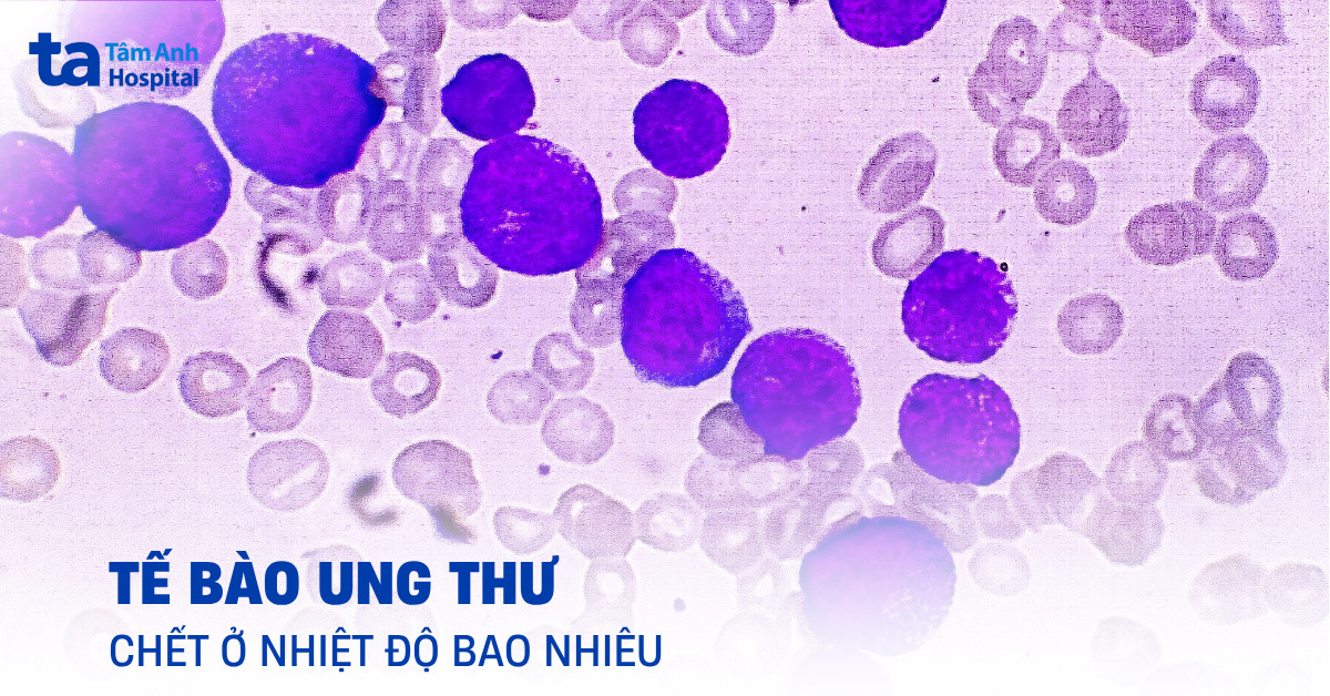 Tế bào ung thư chết ở nhiệt độ bao nhiêu độ C?