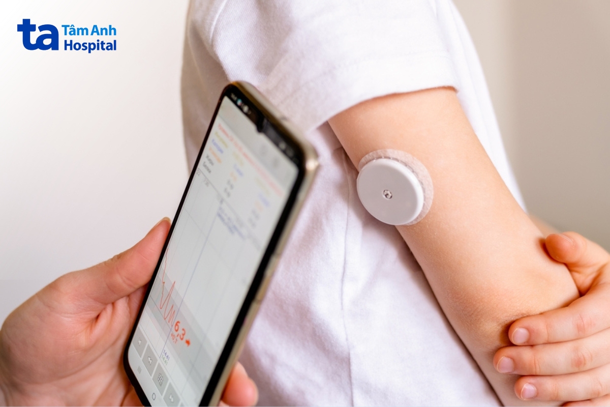 thiết bị đo đường huyết liên tục sử dụng cảm biến đặt dưới da để ghi nhận chỉ số glucose 24_7