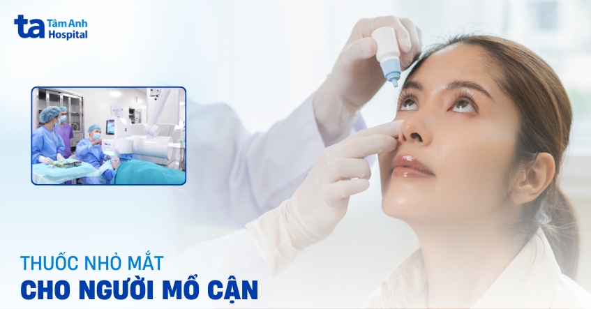 Nên dùng thuốc nhỏ mắt cho người mổ cận loại nào?