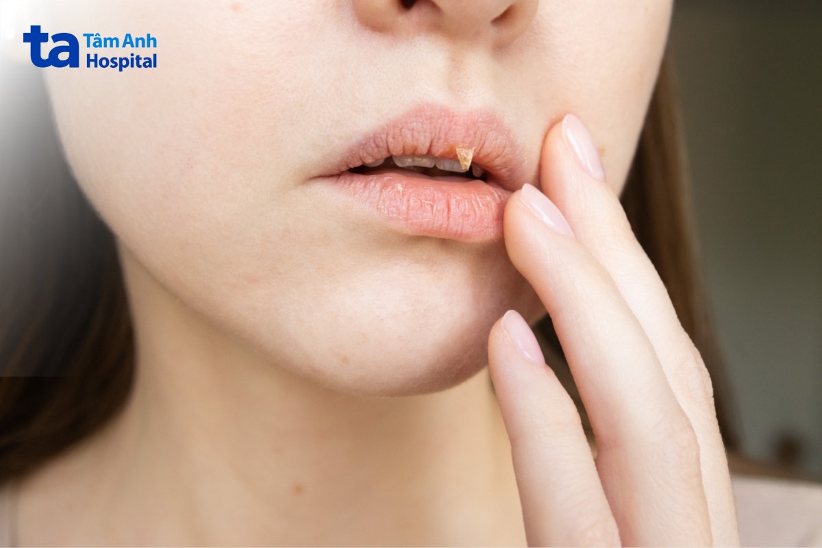 người lớn uống kháng sinh bị tiêu chảy