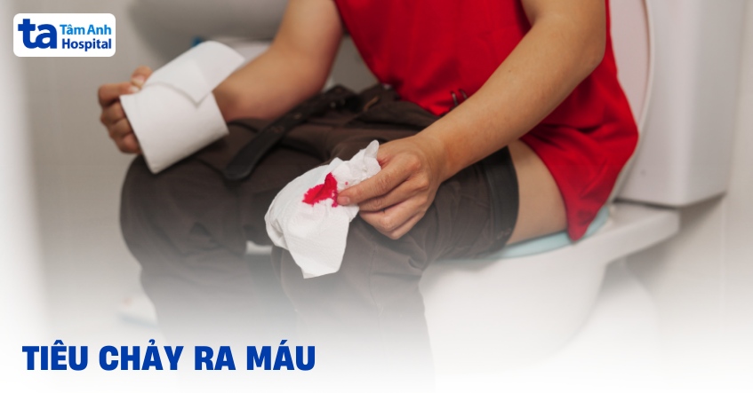 Tiêu chảy ra máu: Tình trạng không thể xem thường