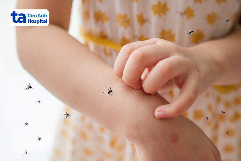 phòng bệnh sốt xuất huyết cho trẻ mầm non