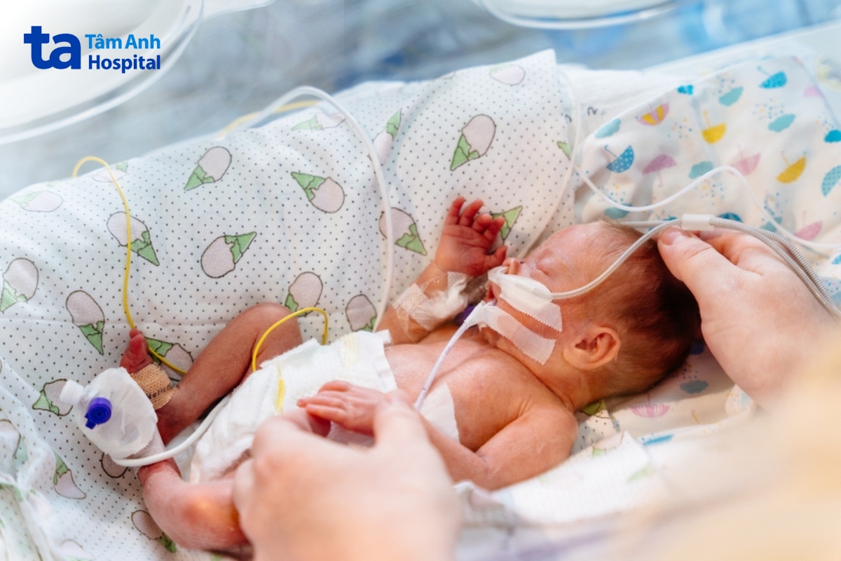 trẻ sinh non phải thở máy kéo dài có nguy cơ loạn sản phế quản phổi cao