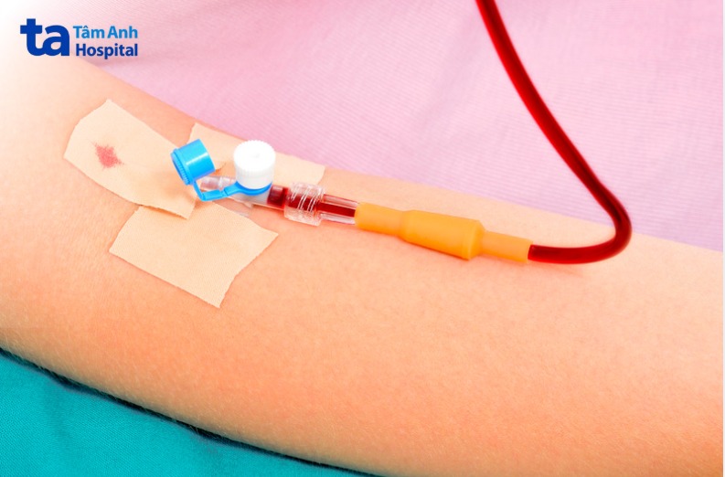 Truyền Tiểu Cầu Trị Sốt Xuất Huyết