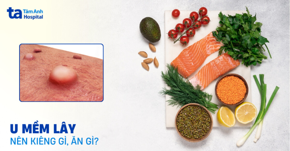 U mềm lây kiêng ăn gì? Chế độ ăn uống giúp da nhanh hồi phục