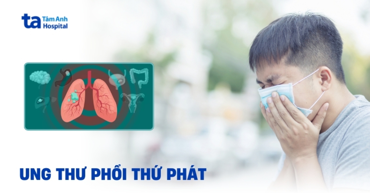 Ung thư phổi thứ phát là gì? Hiểu đúng và kiểm soát kịp thời