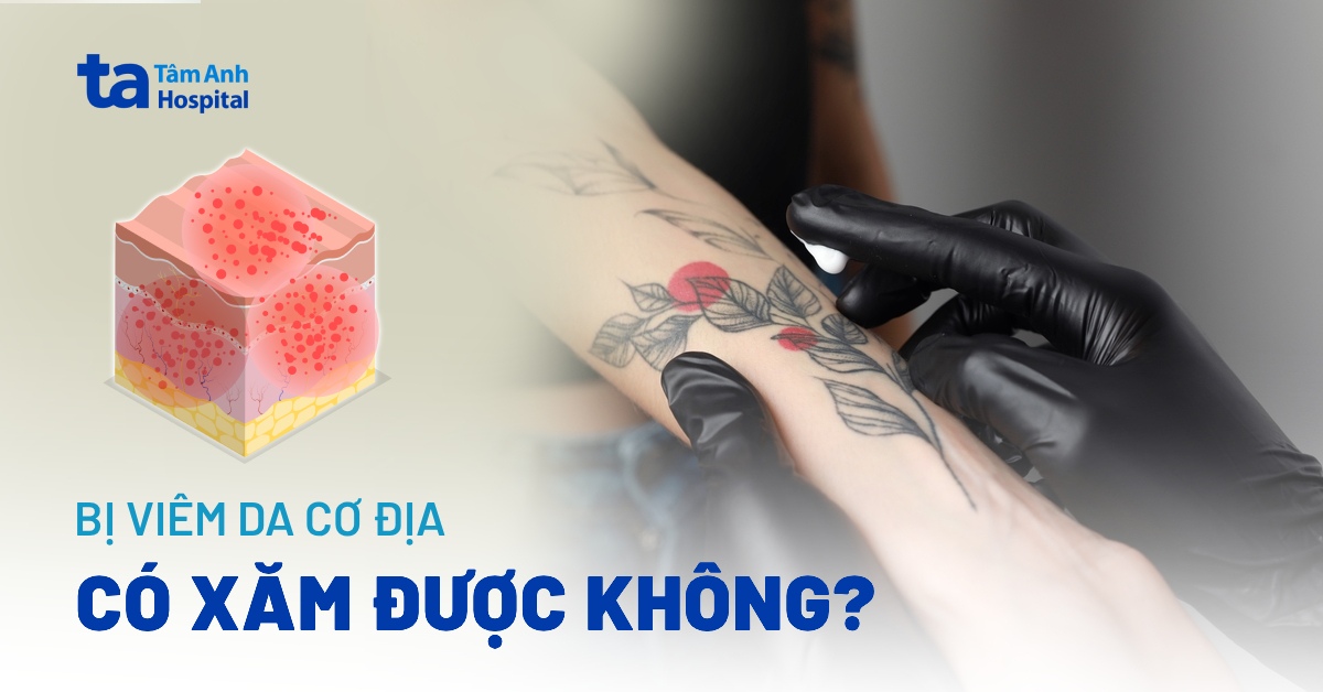 Đang bị viêm da cơ địa có xăm được không?