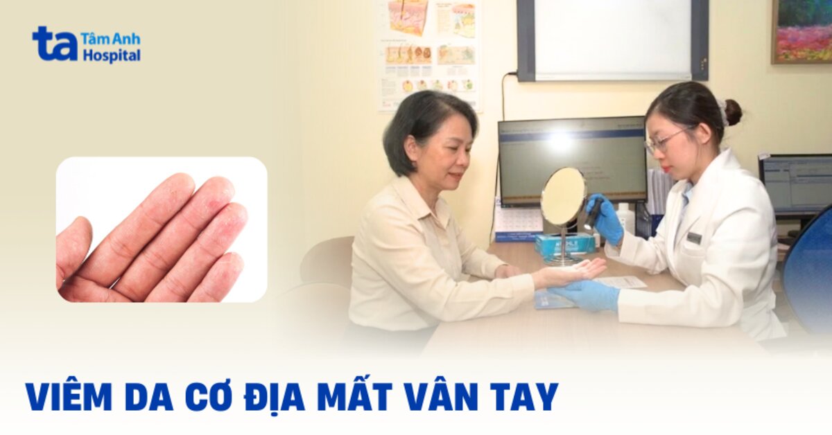 Viêm da cơ địa mất vân tay, phải làm thế nào?