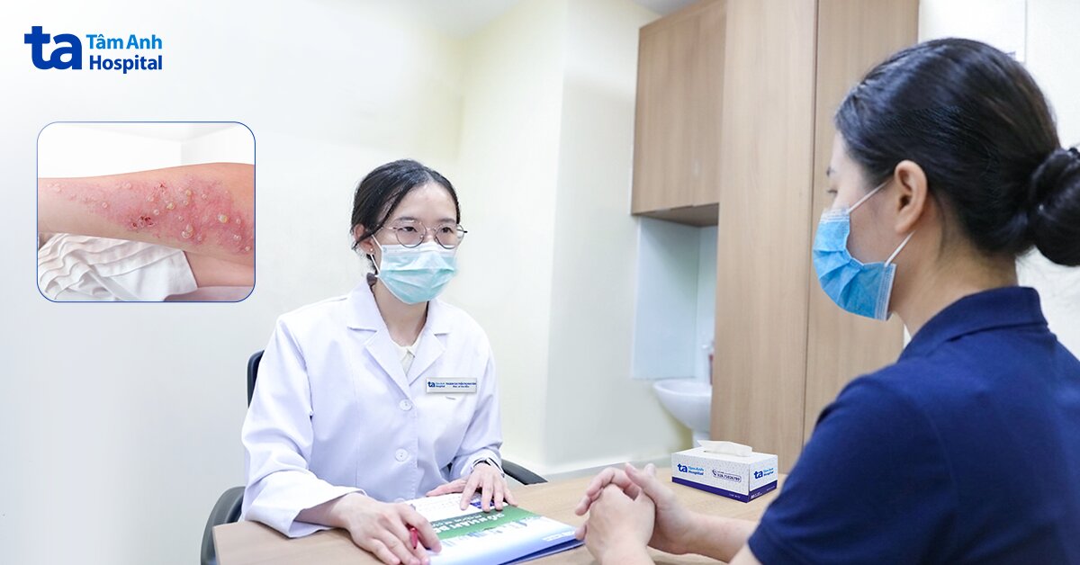 Viêm da lan rộng sau một tuần tự xử lý vết kiến ba khoang