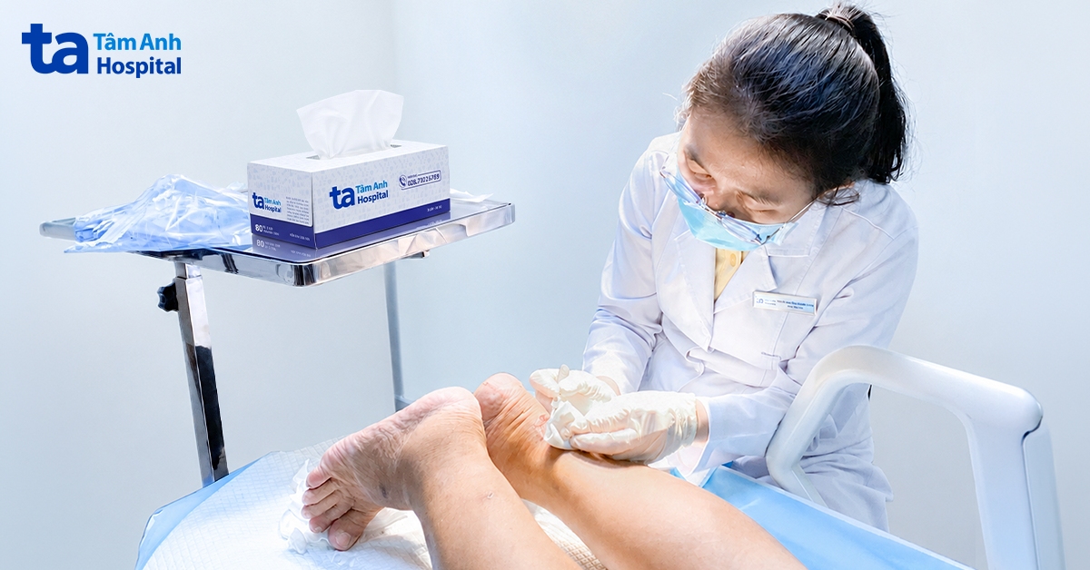 Viêm gân vì biến chứng tiểu đường