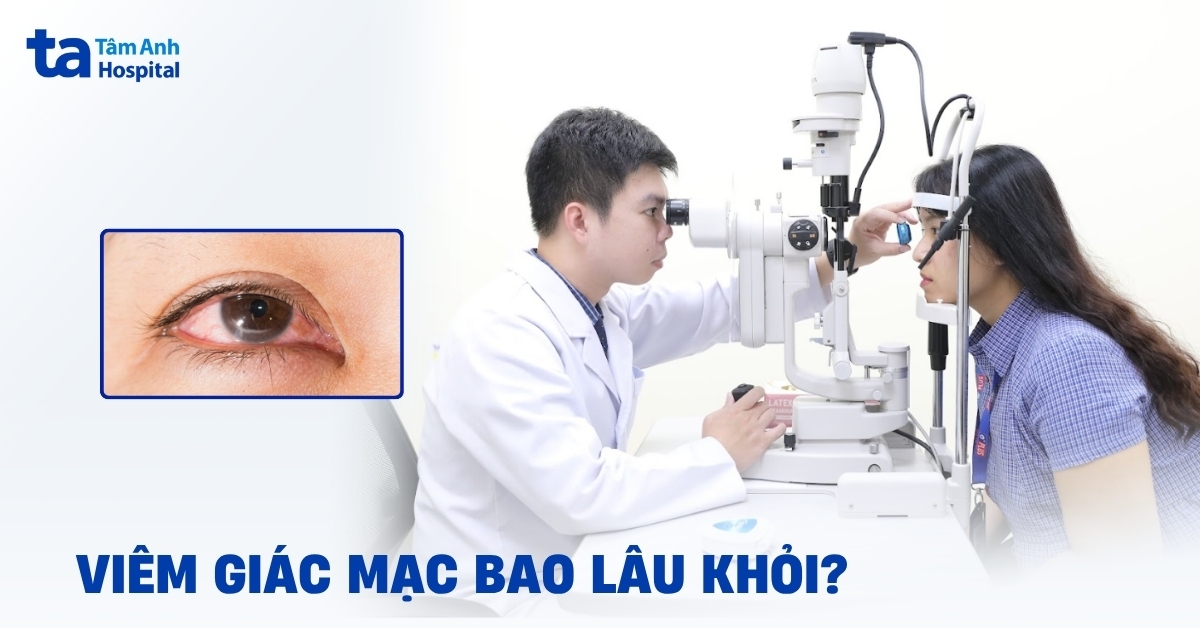 Viêm giác mạc bao lâu khỏi? Thời gian hồi phục sau điều trị
