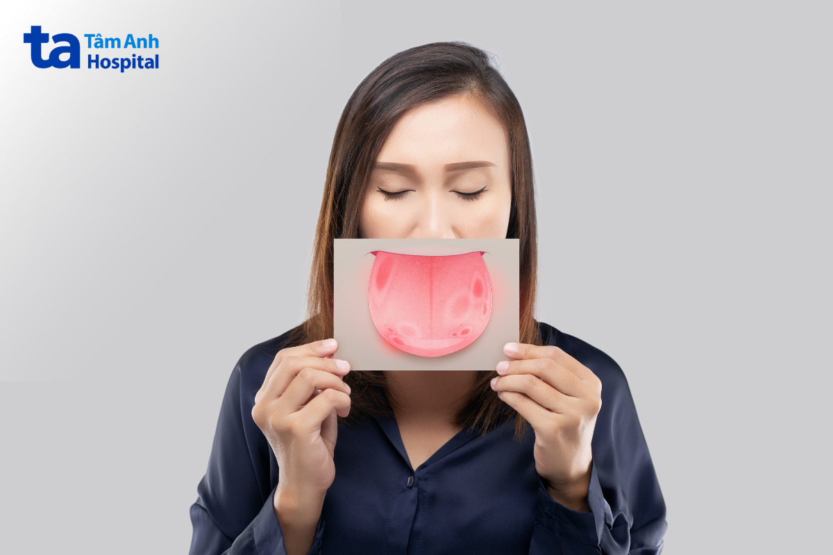 viêm loét miệng do hóa trị gây khô miệng