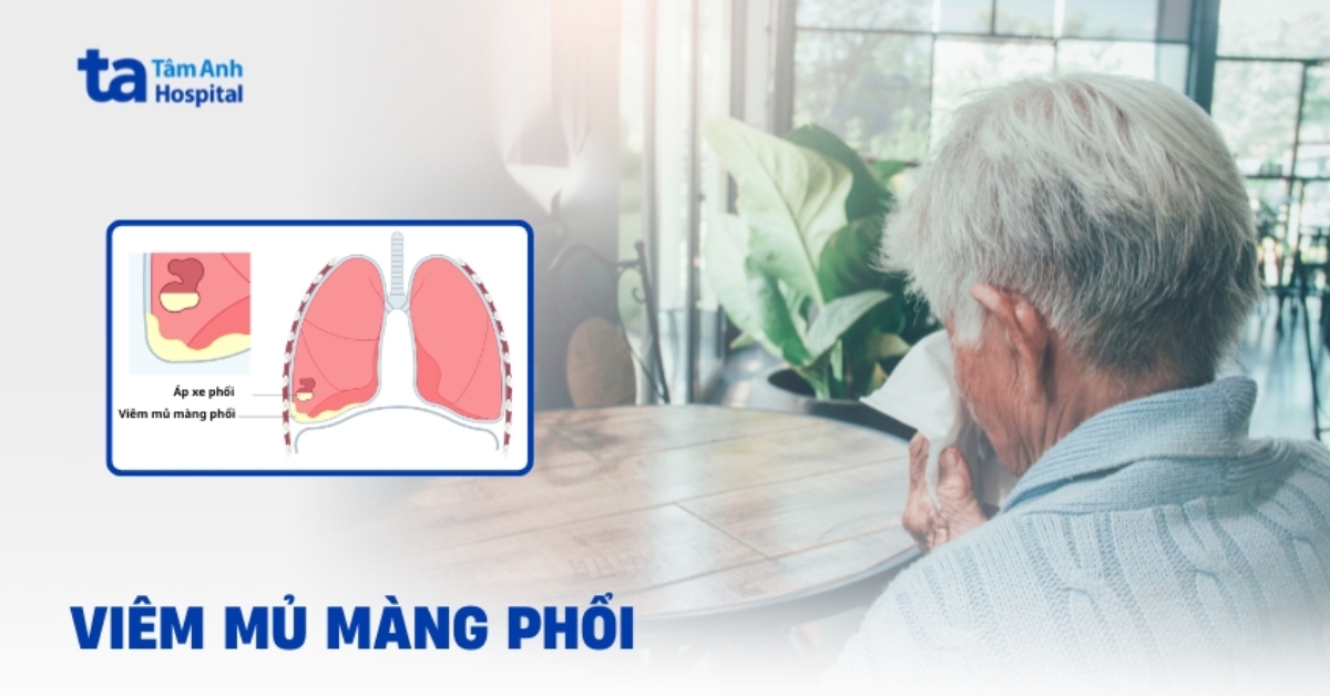 Viêm Mủ Màng Phổi Cần Phải Xử Trí Như Thế Nào
