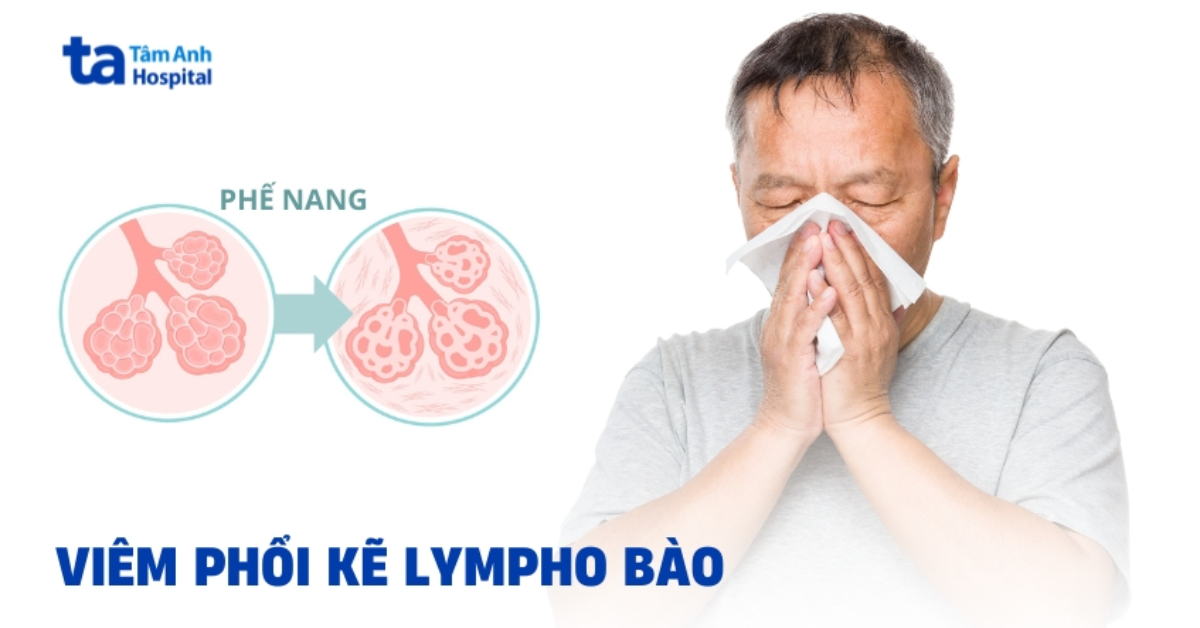 Viêm Phổi Kẽ Lympho Bào