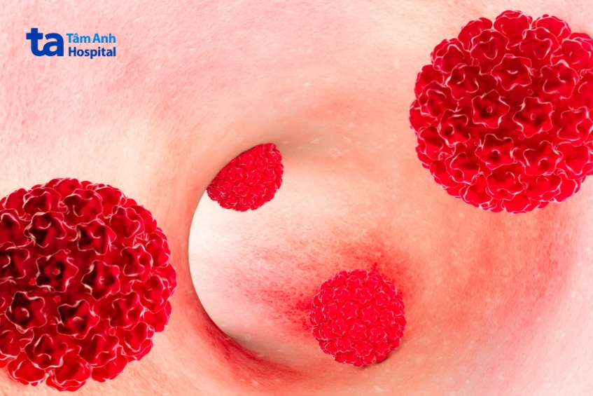 Mô phỏng virus HPV hiện diện trên niêm mạc cổ tử cung.