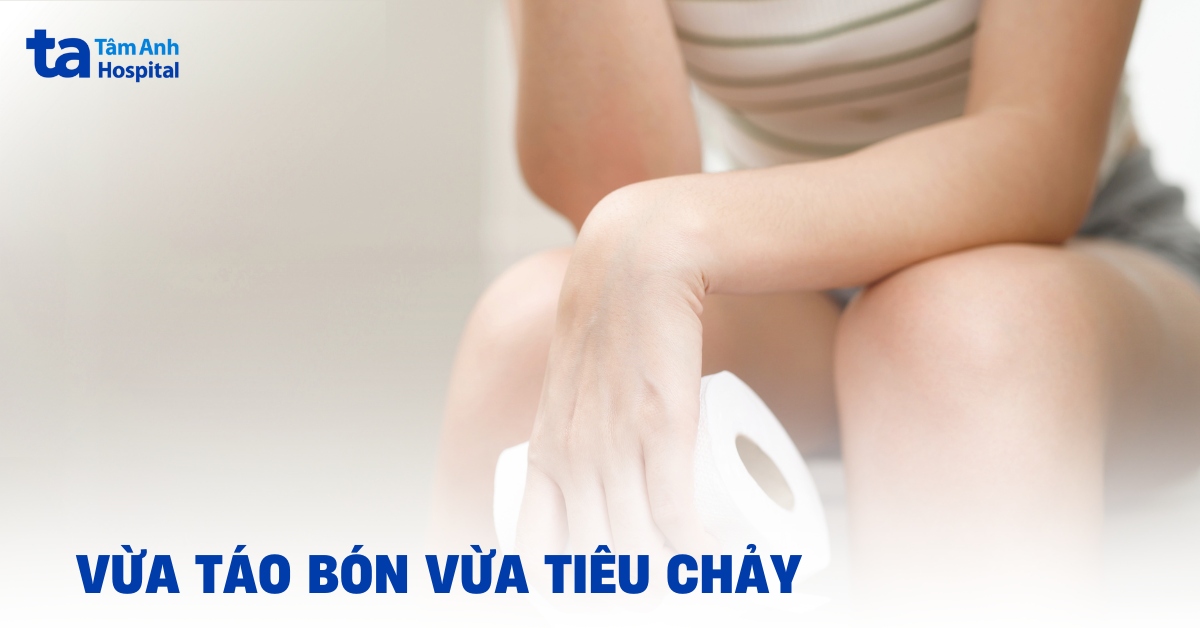 Vừa táo bón vừa tiêu chảy cần hướng xử trí thế nào?