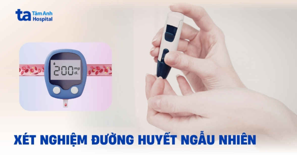 Xét nghiệm đường huyết ngẫu nhiên (RPG) khi nào cần thực hiện?
