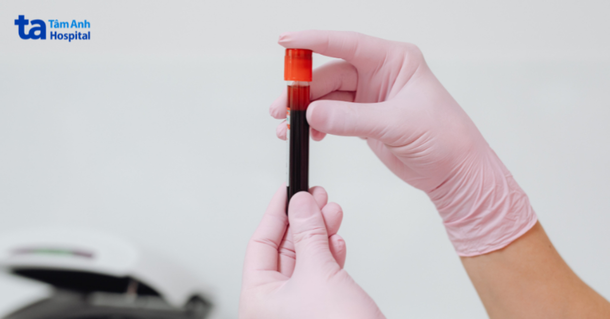 xét nghiệm glucose sau ăn giúp đánh giá khả năng xử lý lượng đường nạp vào cơ thể