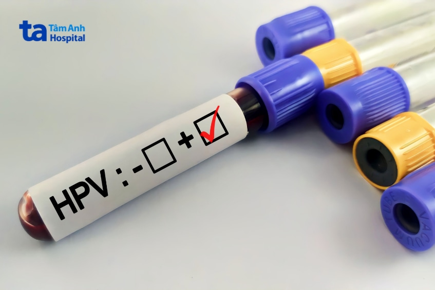 Ống máu xét nghiệm được đánh dấu HPV dương tính