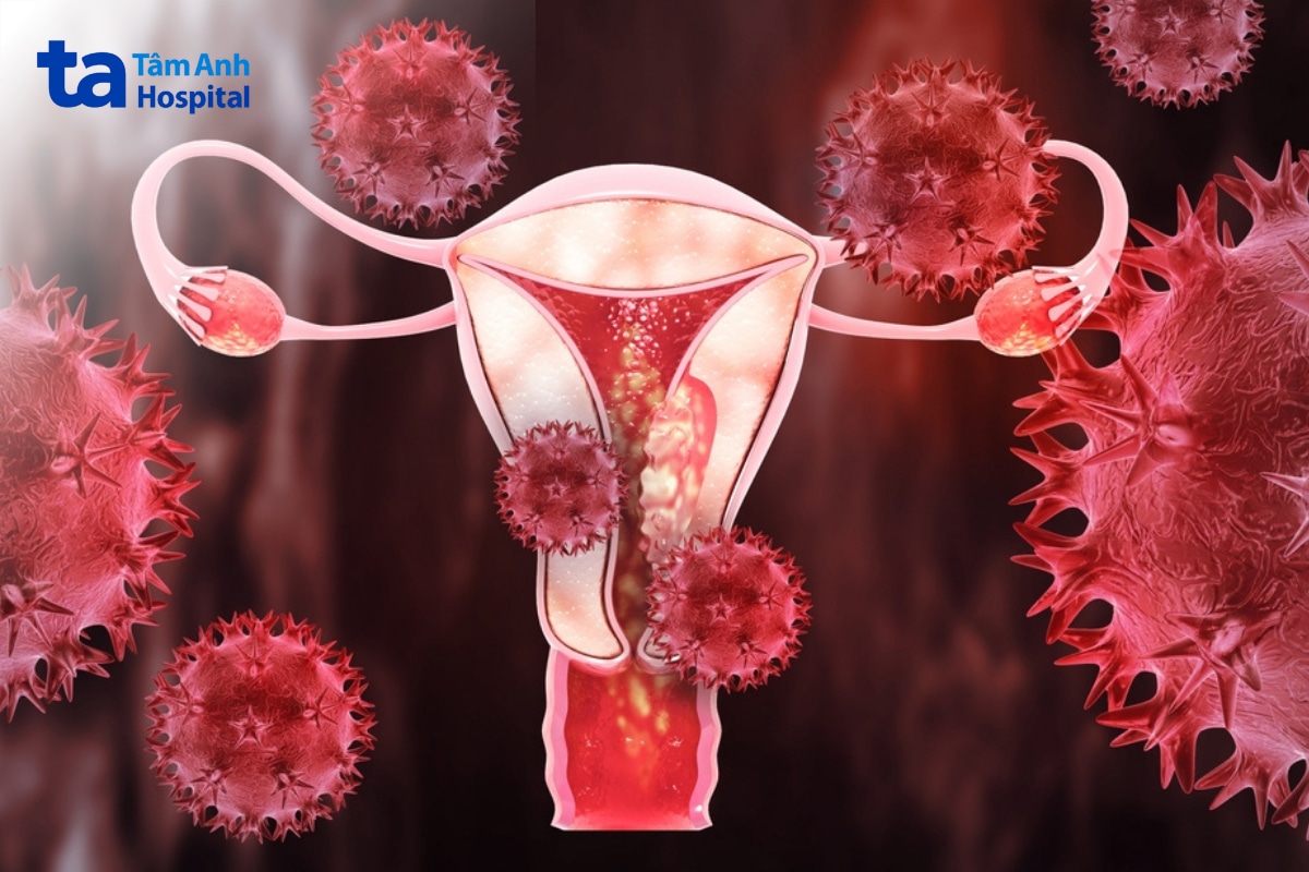 Virus HPV tấn công tử cung, cổ tử cung gây ung thư