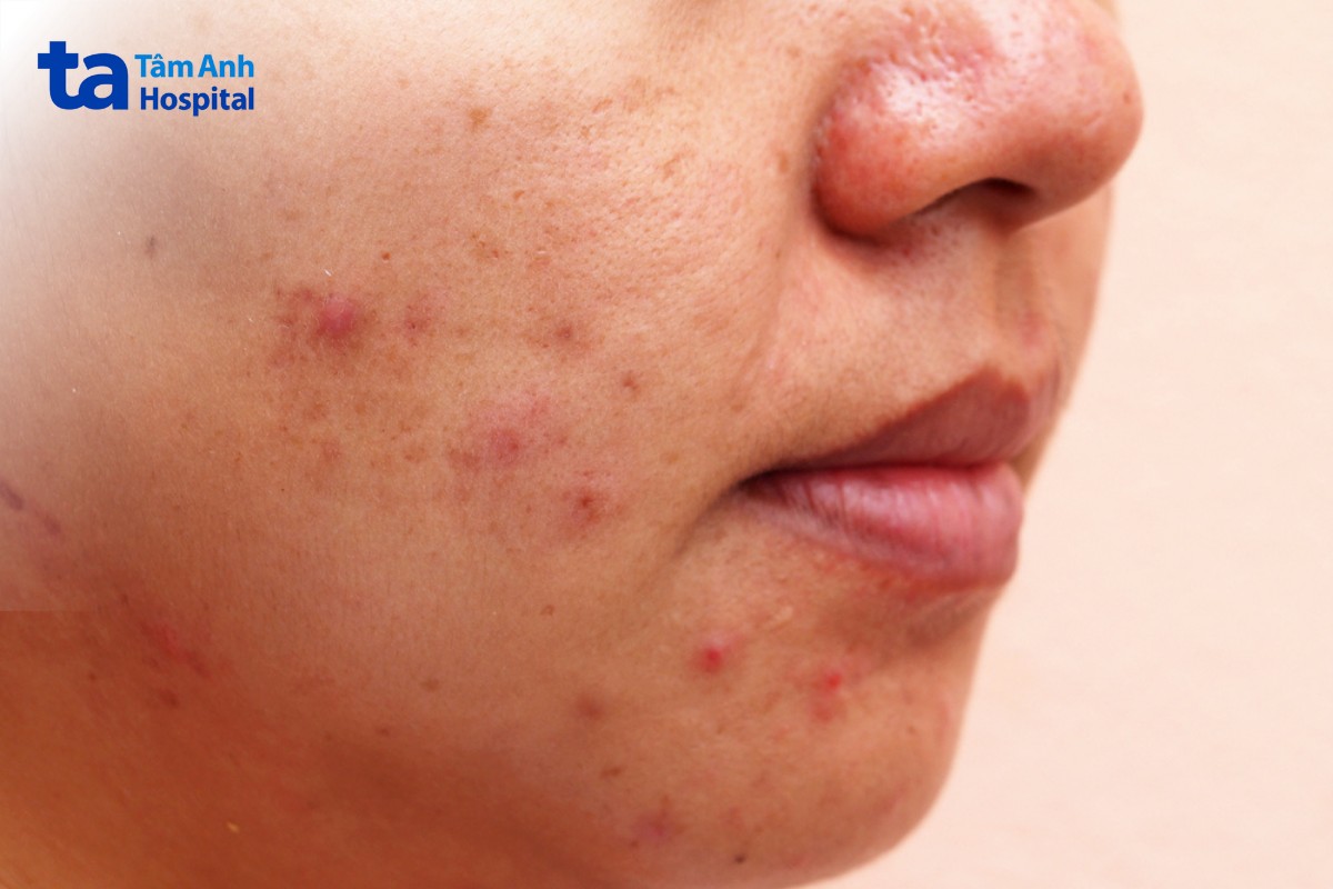 ai phù hợp điều trị bằng plasma