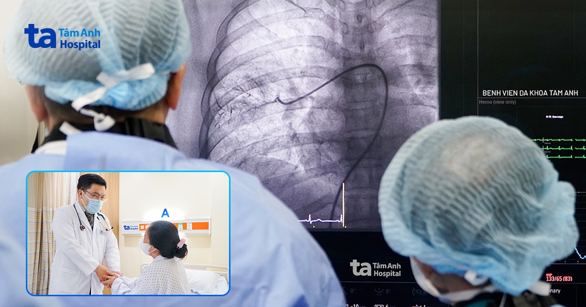 Ba lần nong bóng cứu người phụ nữ tắc động mạch phổi