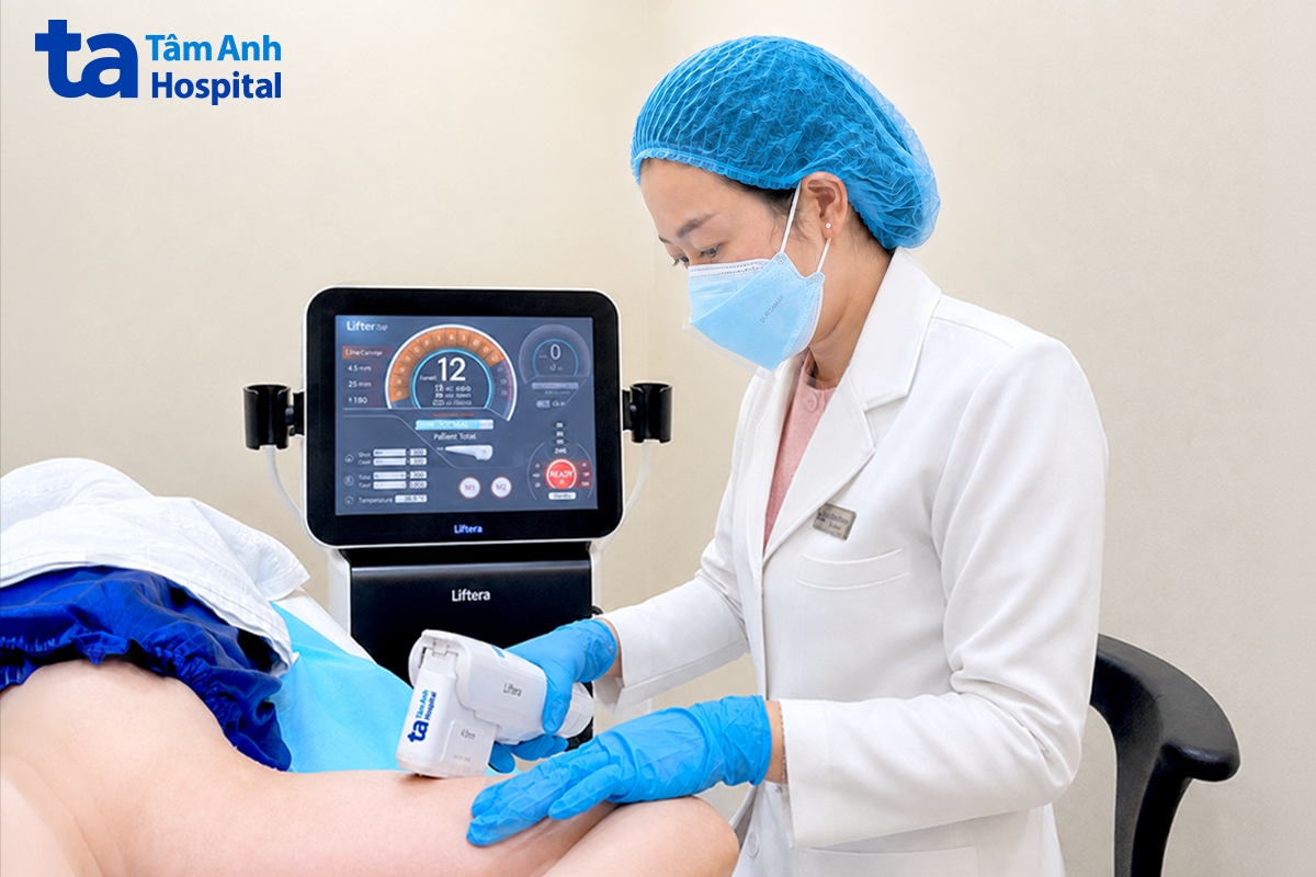 bác sĩ dung sử dụng hifu để săn chắc phần bắp tay cho chị thủy