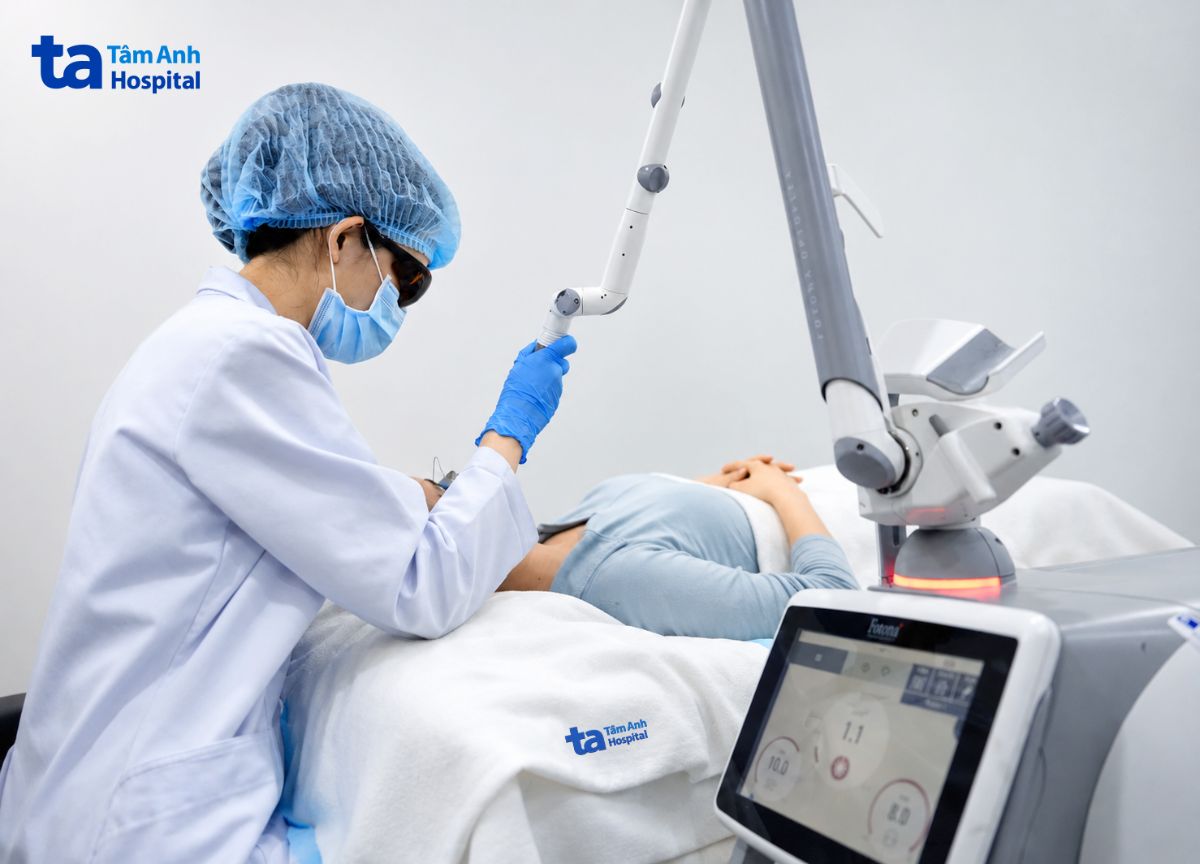 bác sĩ sử dụng laser pico điều trị vết thâm mụn do thủy đậu