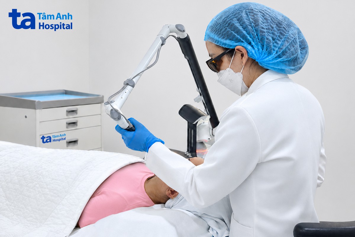 bác sĩ sử dụng laser pico pro trị nám cho chị hòa