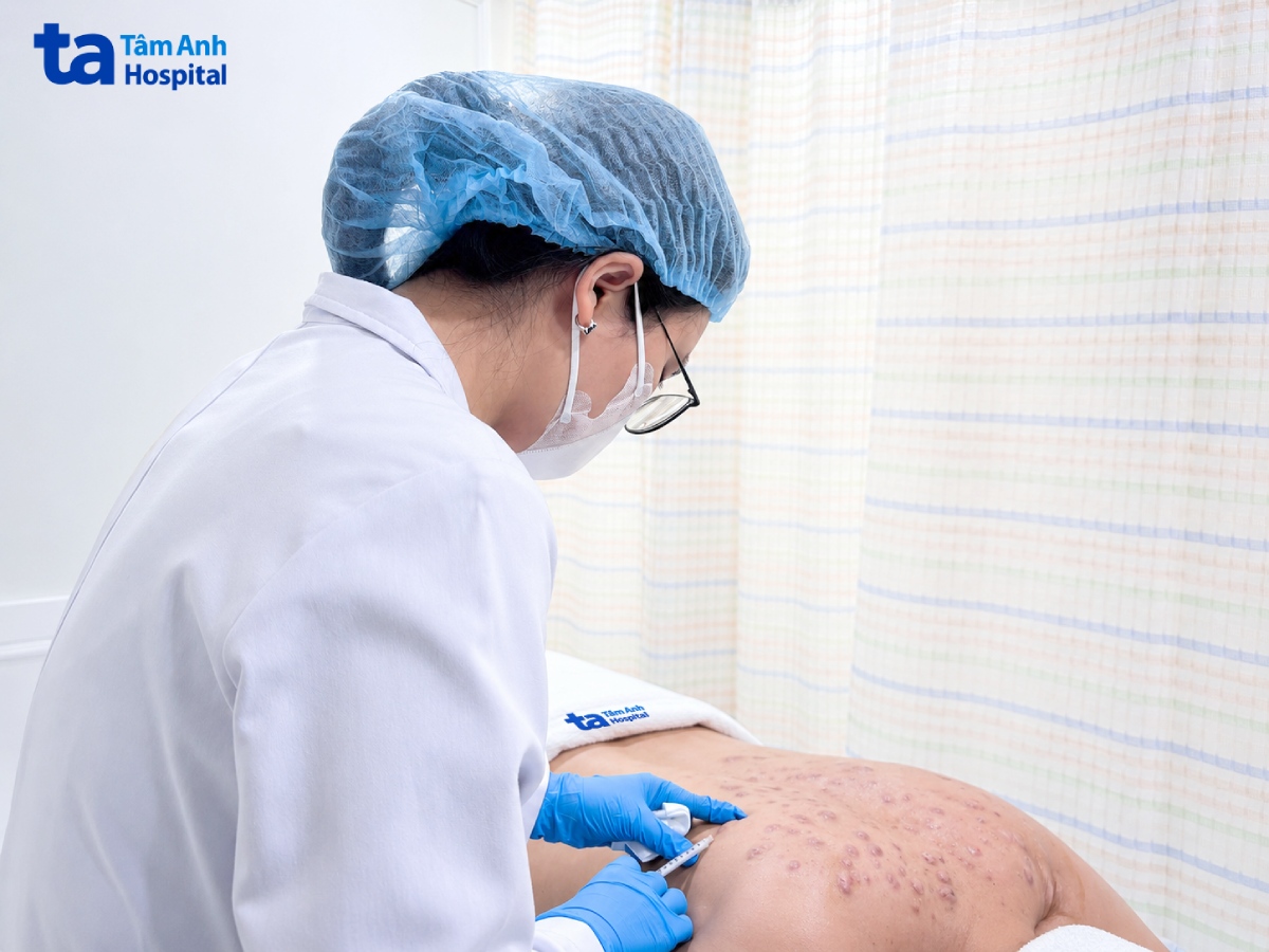 bác sĩ tiêm trị sẹo lồi cho anh nam