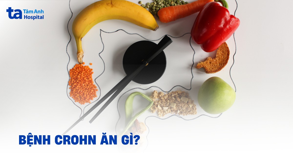 Bệnh Crohn ăn gì và không nên ăn gì? Các gợi ý trong chế độ ăn