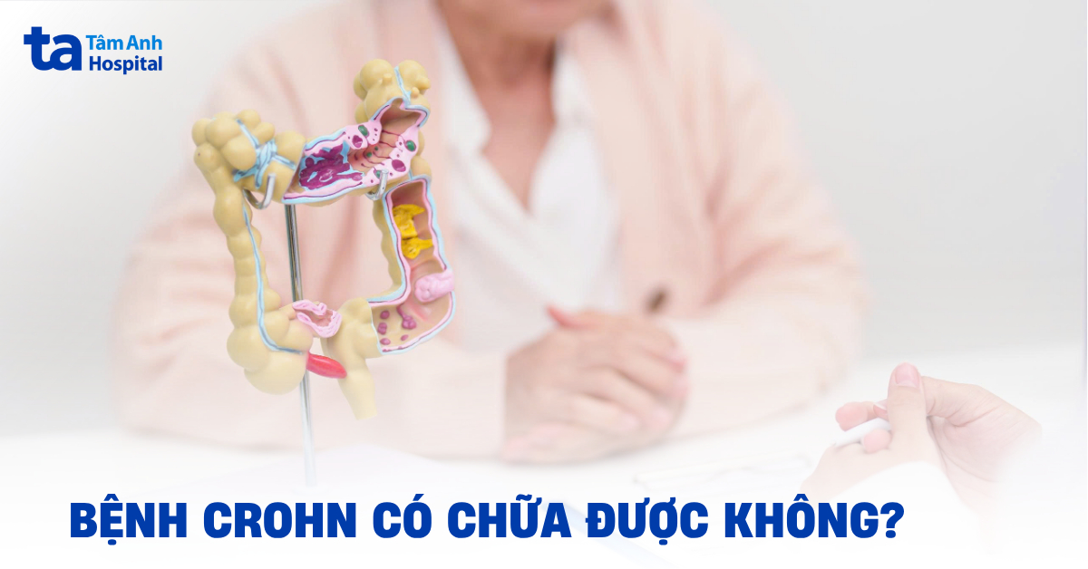 Bệnh Crohn có chữa được không? Hướng xử lý