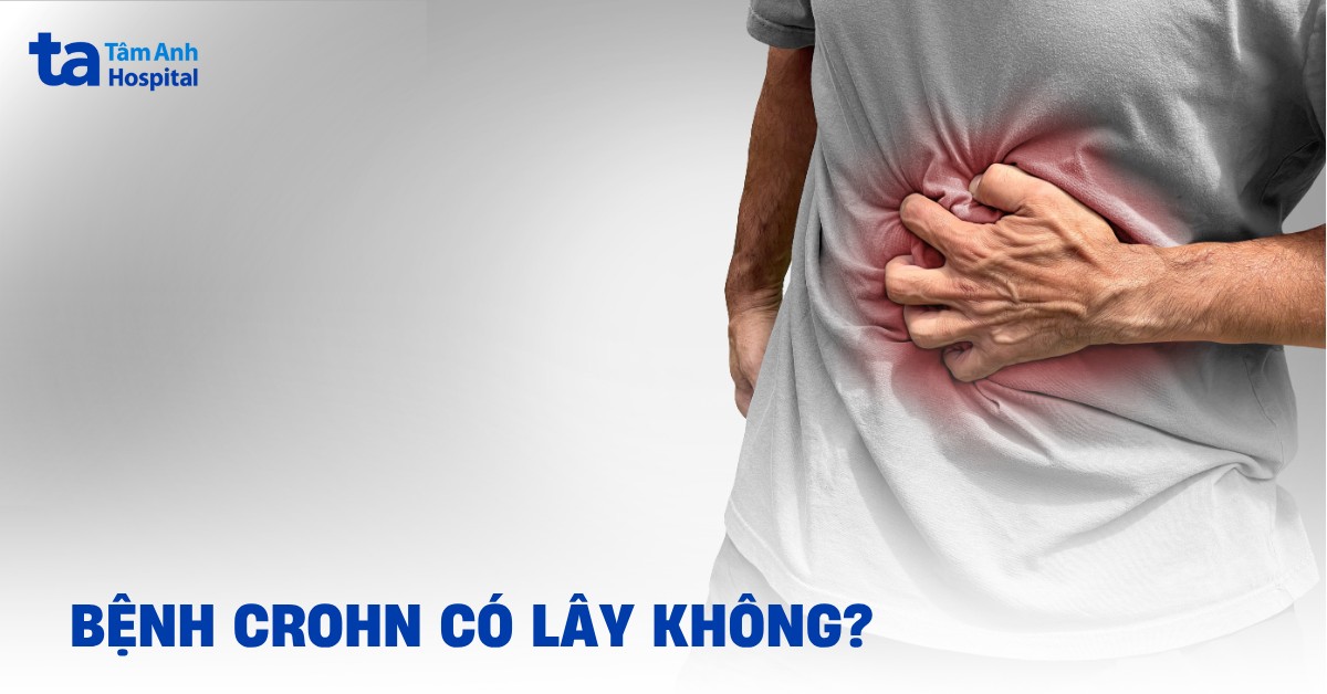 Bệnh Crohn Có Lây Không