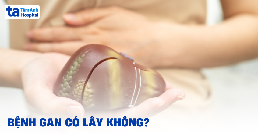 Giải đáp thắc mắc: Bệnh gan có lây không?
