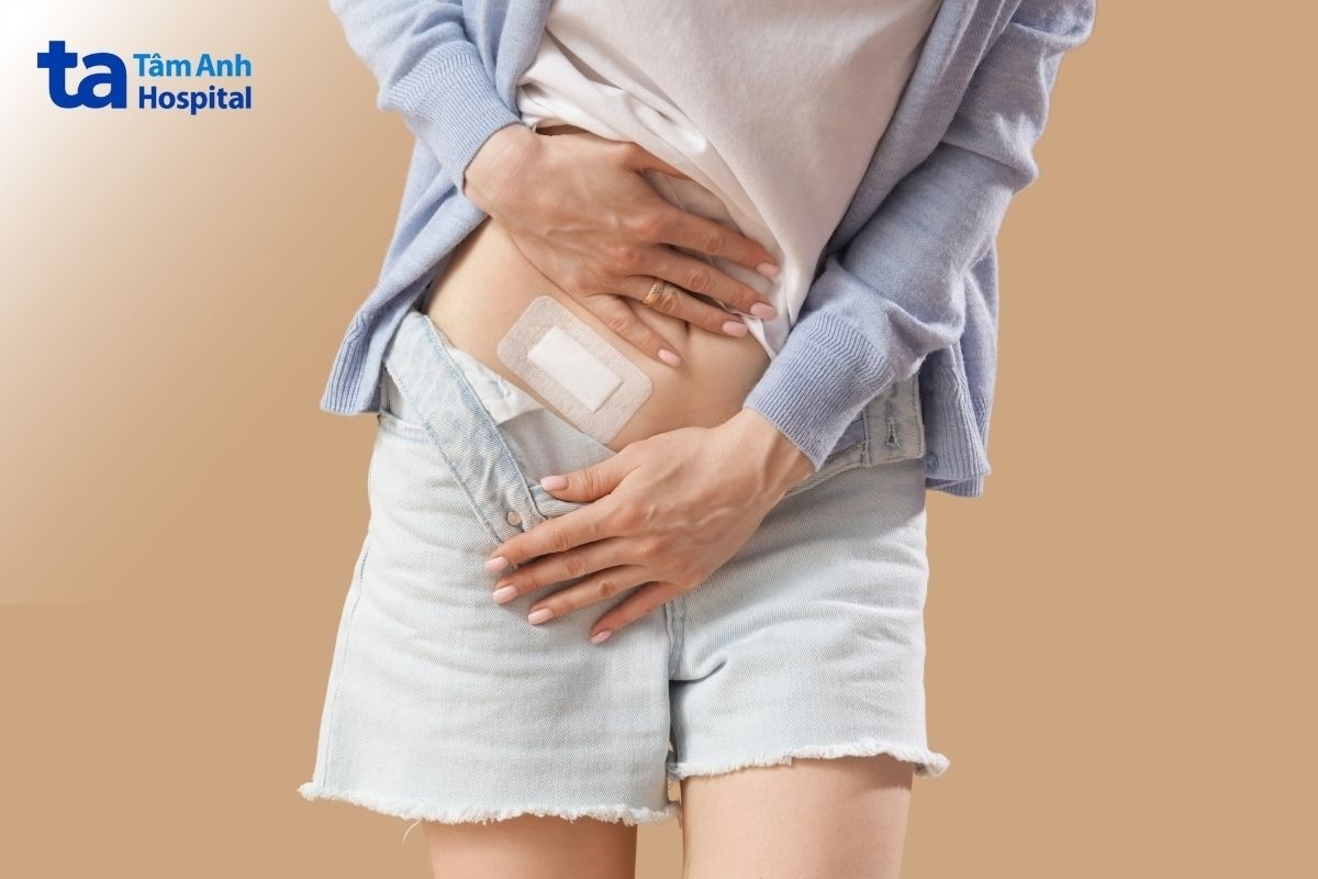 Bị Tiêu Chảy Sau Khi Mổ Ruột Thừa
