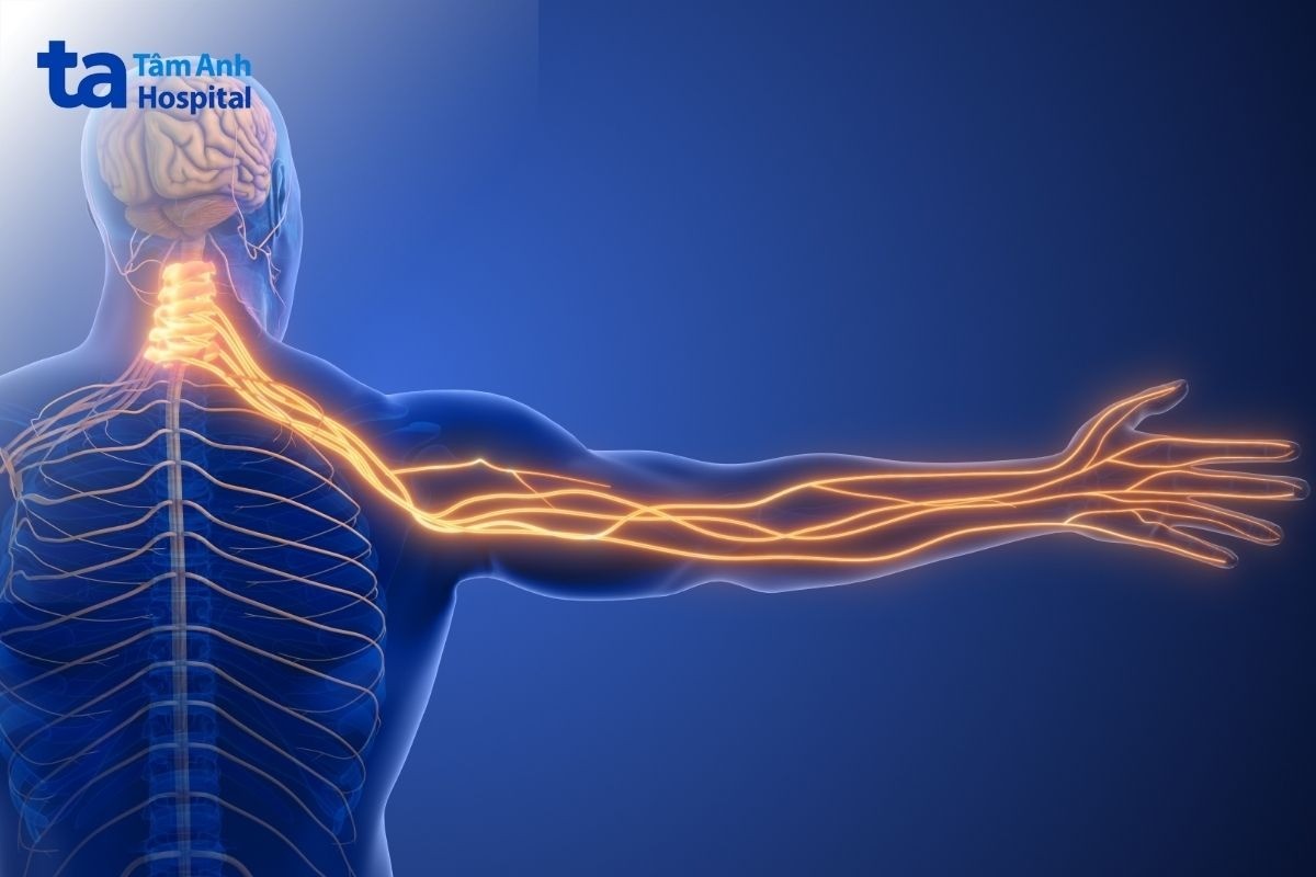 biến chứng chữa vôi hóa đốt sống cổ