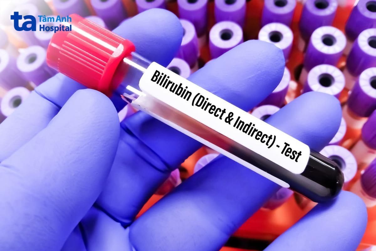 bilirubin gián tiếp là gì