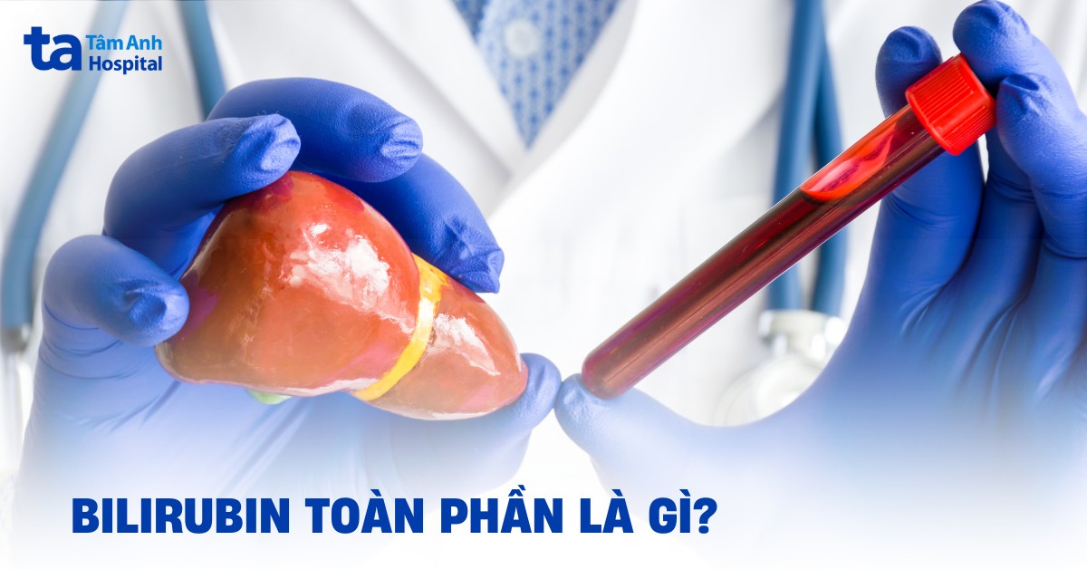 Bilirubin toàn phần là gì? Mức bình thường và nguyên nhân tăng