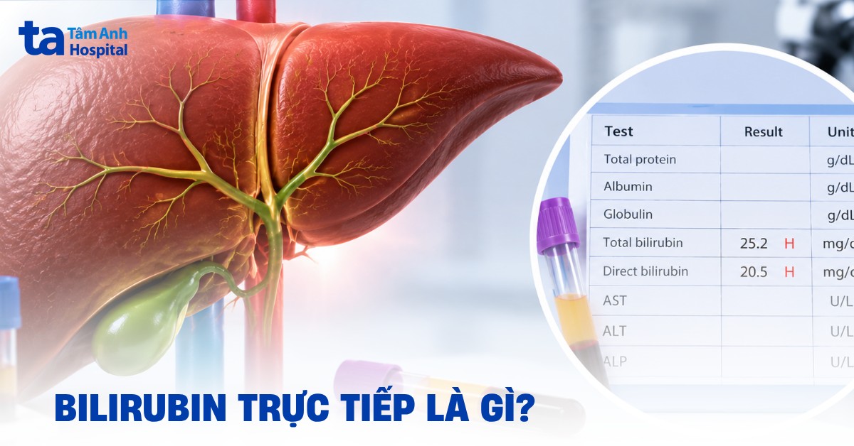 Bilirubin trực tiếp là gì? Ý nghĩa trong chẩn đoán và xét nghiệm