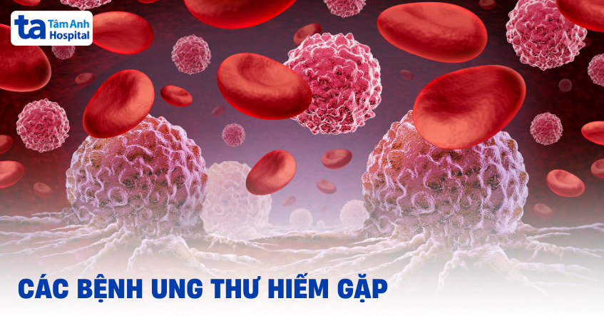 Các bệnh ung thư hiếm gặp gồm những loại nào?
