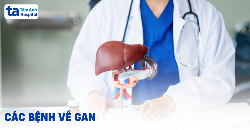 Tổng hợp các bệnh về gan phổ biến dễ mắc phải