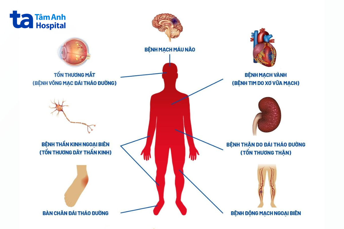 các biến chứng nguy hiểm của bệnh tiểu đường