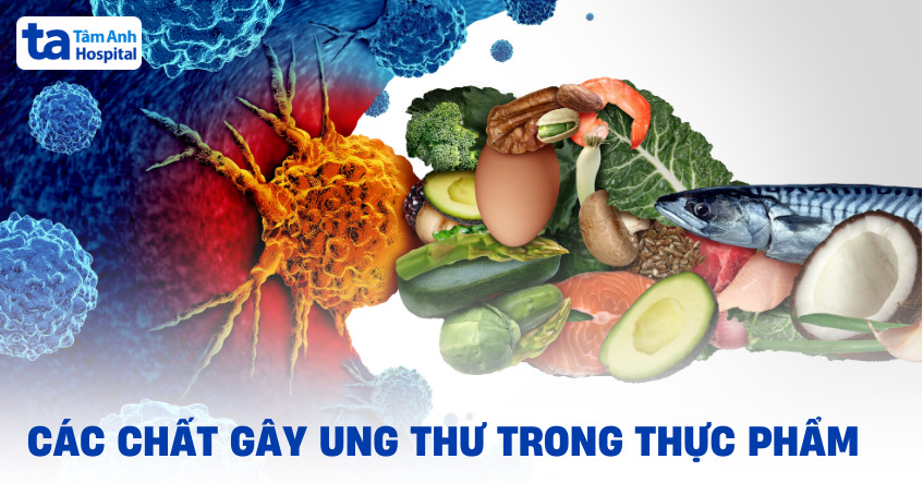 Các chất gây ung thư trong thực phẩm bao gồm những gì?