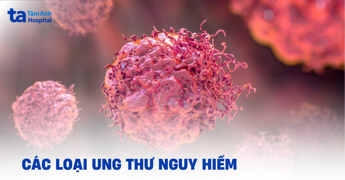 Tìm hiểu các loại ung thư nguy hiểm hiện nay