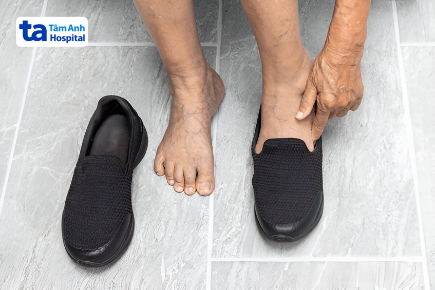 cần đặt gót cân đối và xác định đúng vị trí đầu xương ngón cái