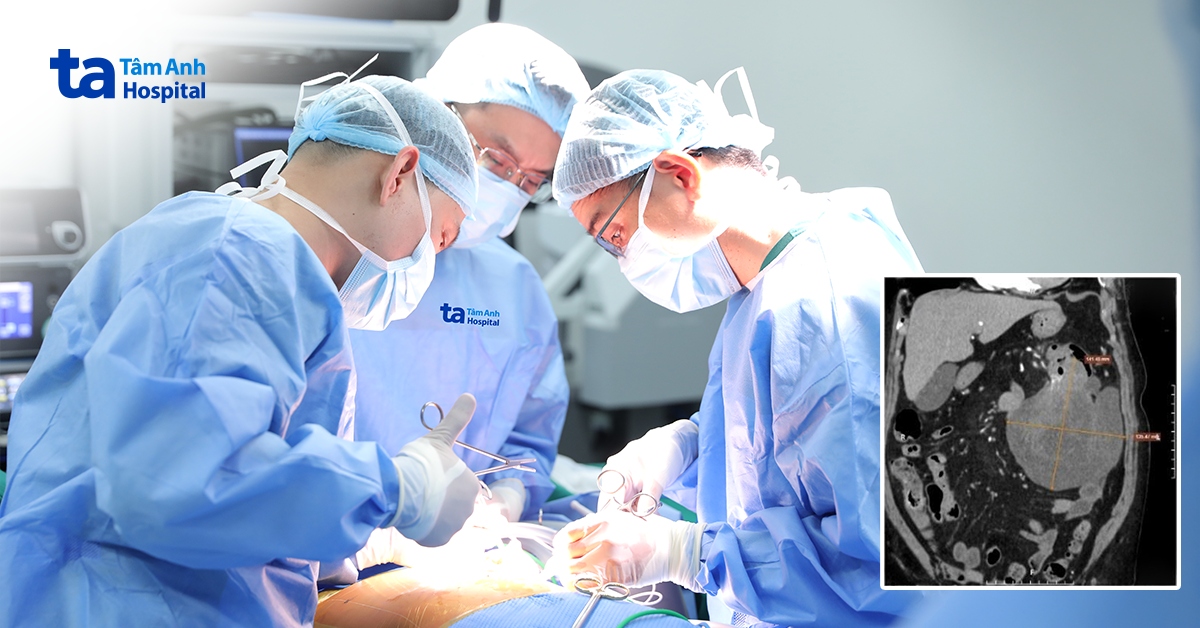Cắt khối ung thư đại tràng thể hiếm gặp cho cụ bà 94 tuổi