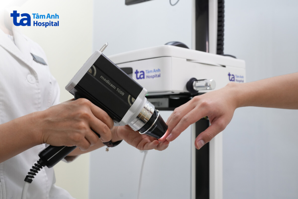 chẩn đoán viêm da đầu chi liên tục