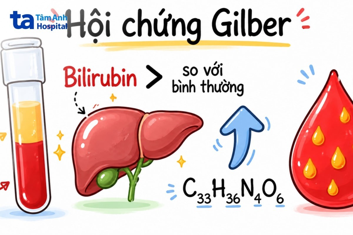 chỉ số bilirubin gián tiếp