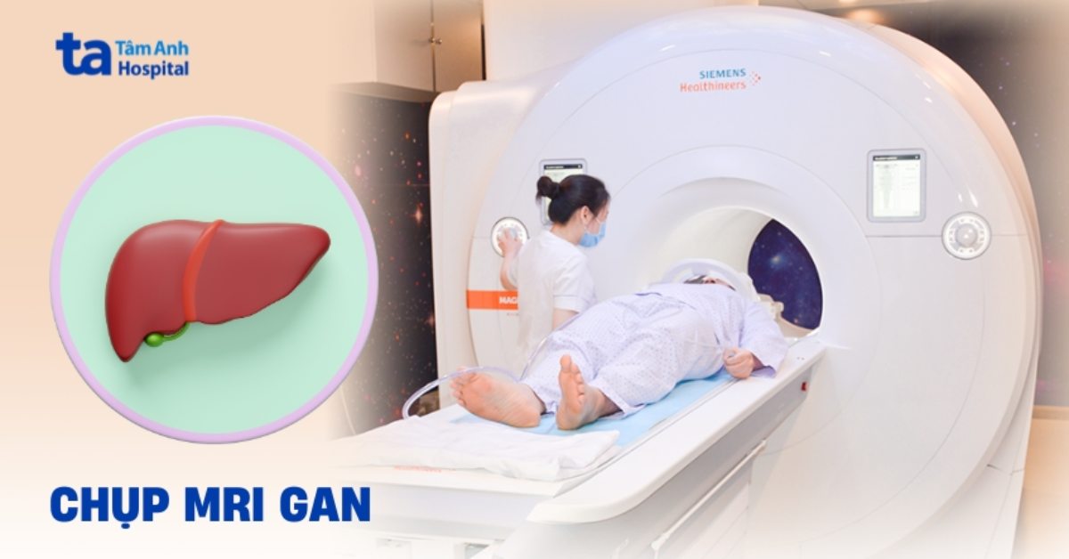 Chụp MRI gan có thể cho thấy những gì?